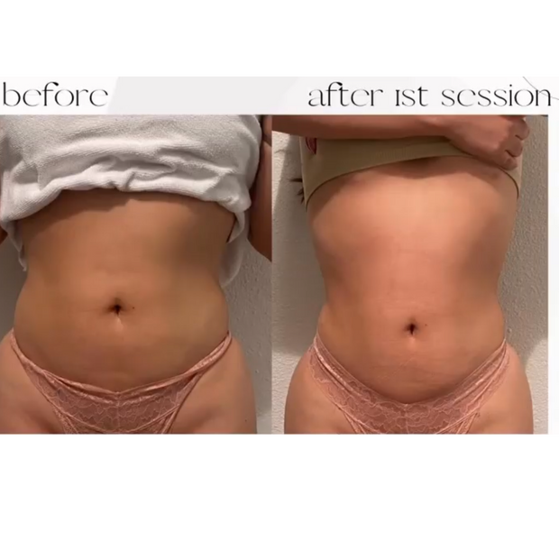 Body sculpting in San Dimas ca 91773 
Body treatments / red light therapy / 
weight loss beautify by jazzy 
