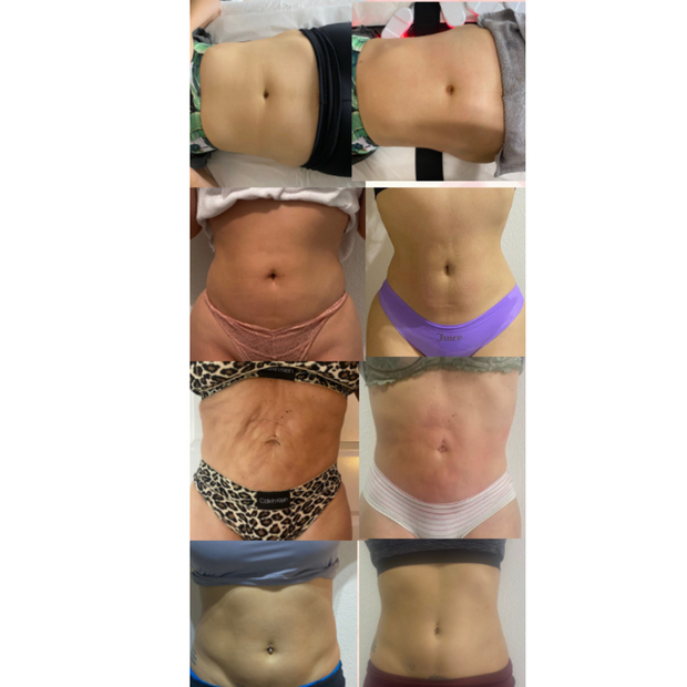 Body sculpting in San Dimas ca 91773 
Body treatments / red light therapy / 
weight loss beautify by jazzy 