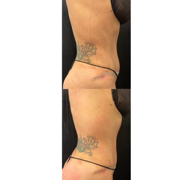 Lymphatic massage post op care Body sculpting in San Dimas ca 91773 
Body treatments / red light therapy / 
weight loss beautify by jazzy 
